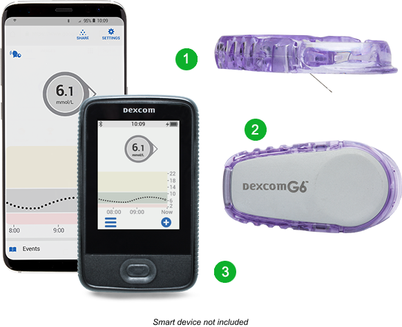 The three components of the Dexcom G6: G6 Sensor, G6 Transmitter, and a display device