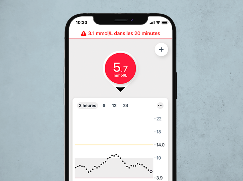 Dexcom G7