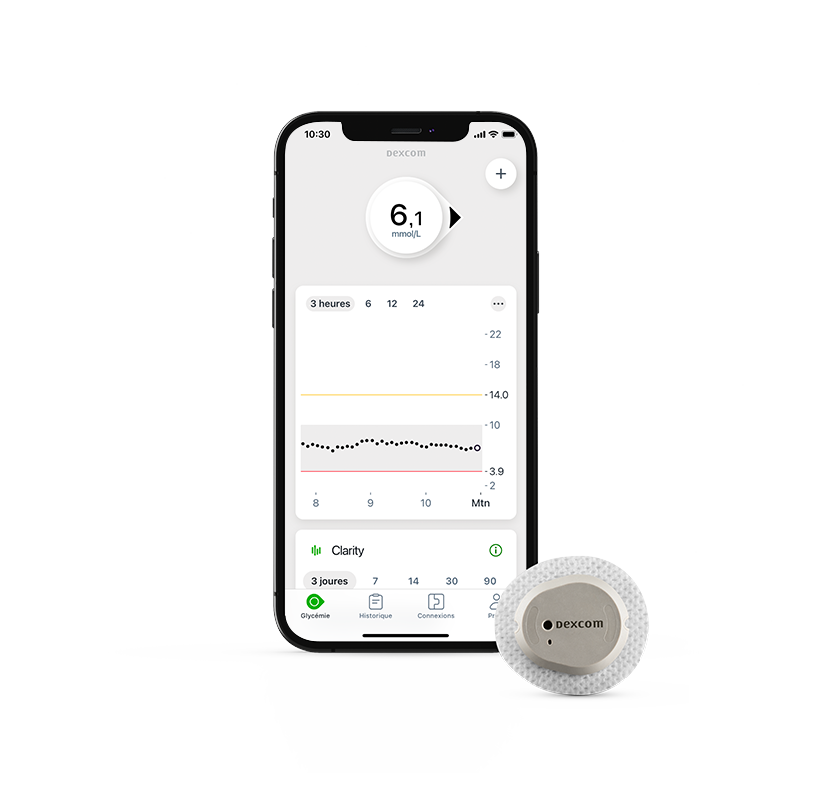 dexcom g7